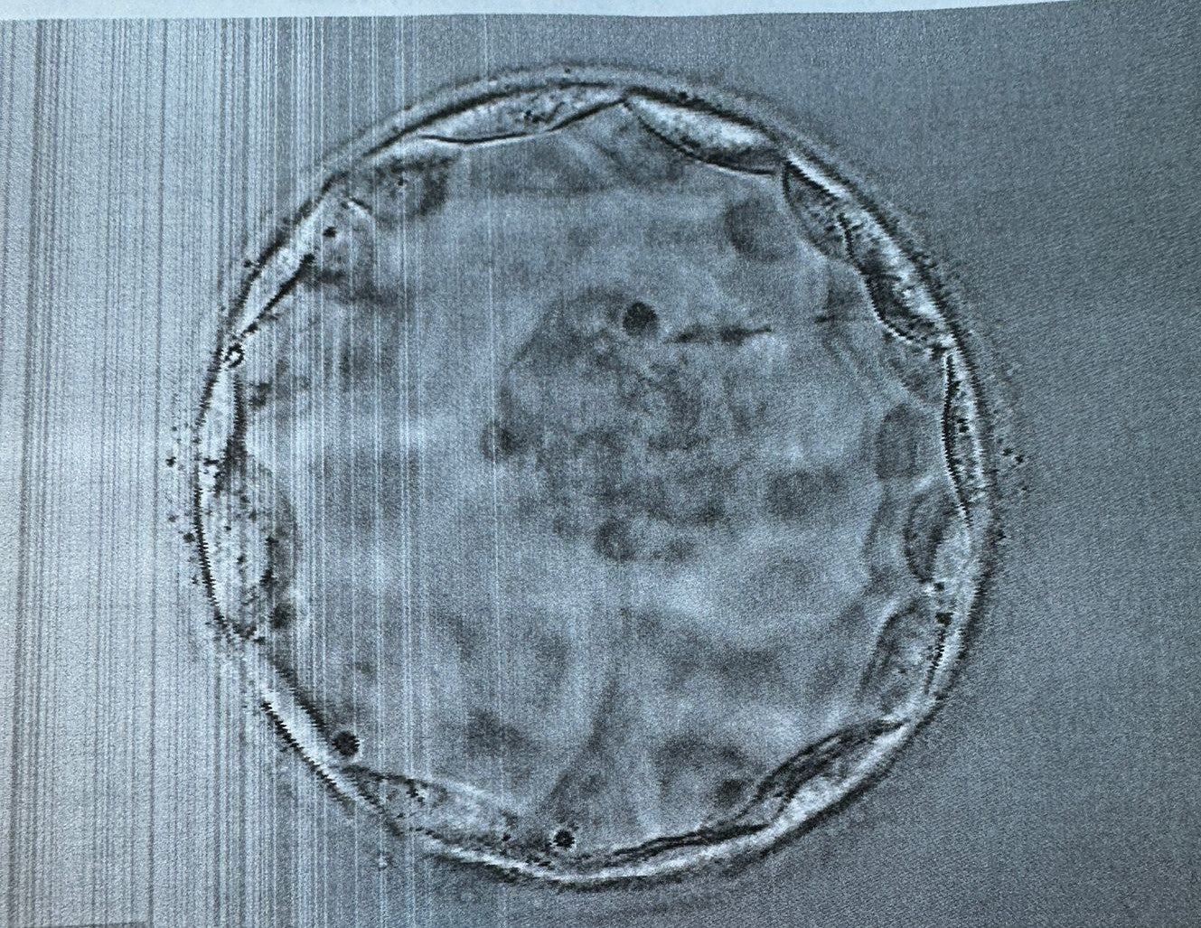 Pulsera Embriones - In-vitro